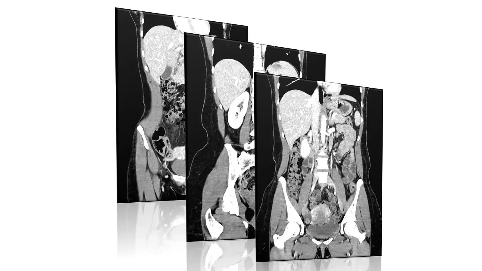 CT scan cross-section of the abdominal and pelvic organs