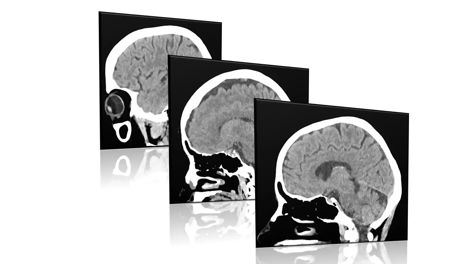CT scan cross-section of the brain and skull