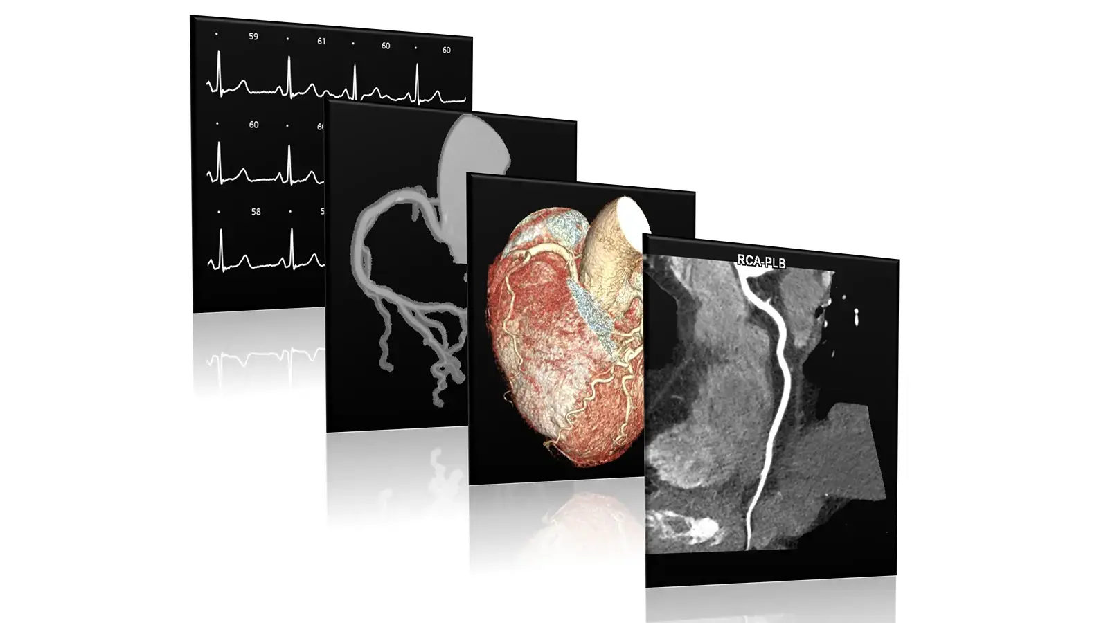 CT scan image of the heart and coronary arteries