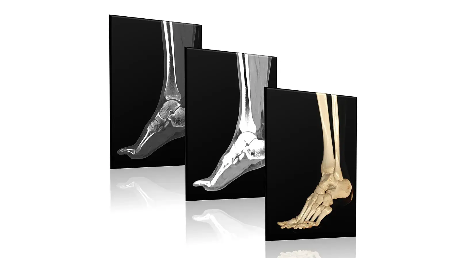 CT scan image of bone and joint structures