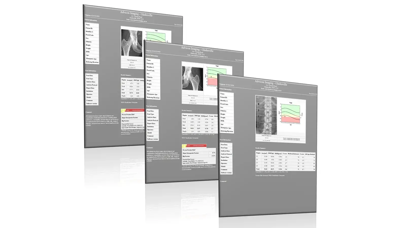 DEXA scan image measuring bone mineral density
