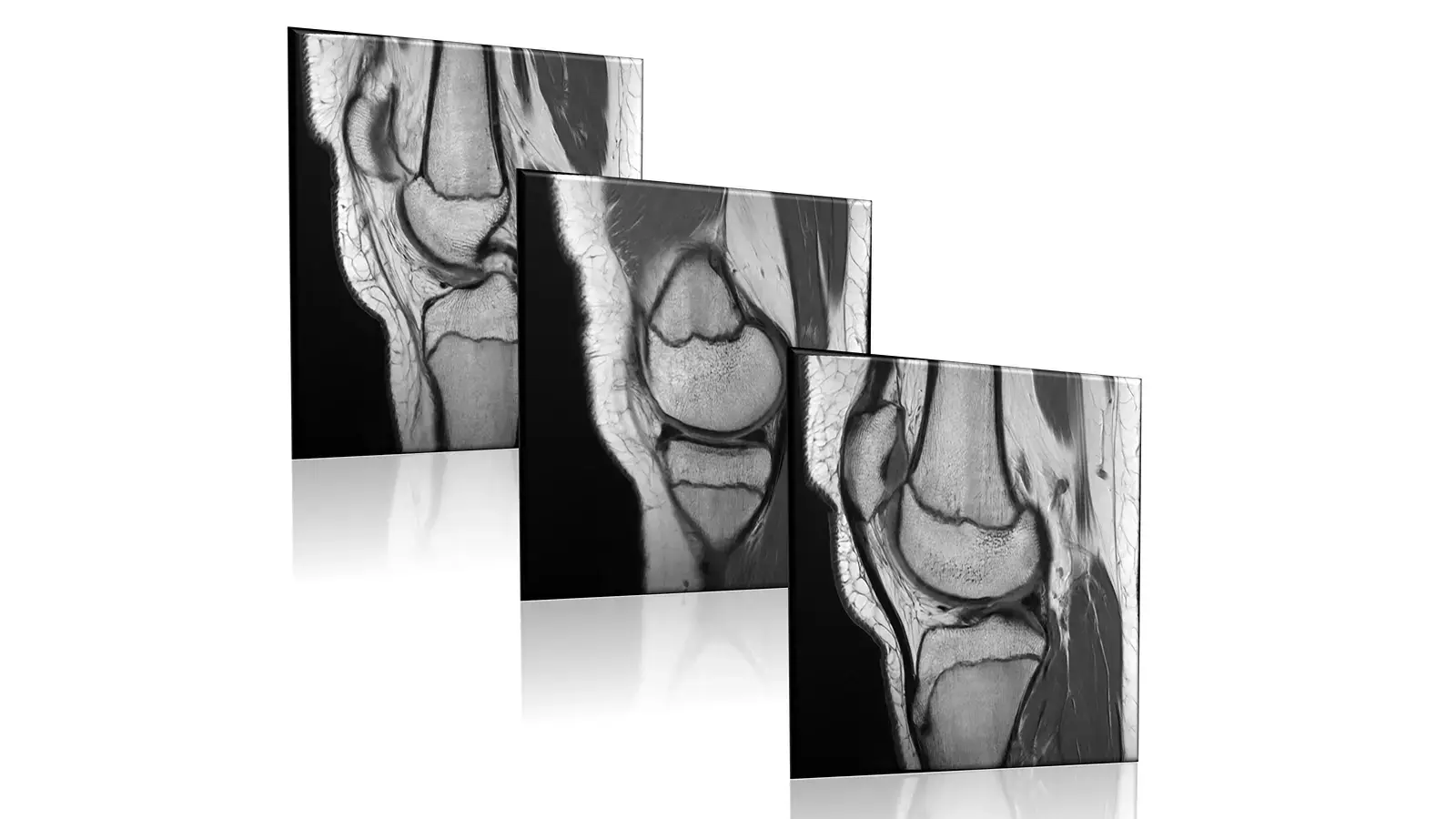 MRI scan image of muscles, joints and connective tissue