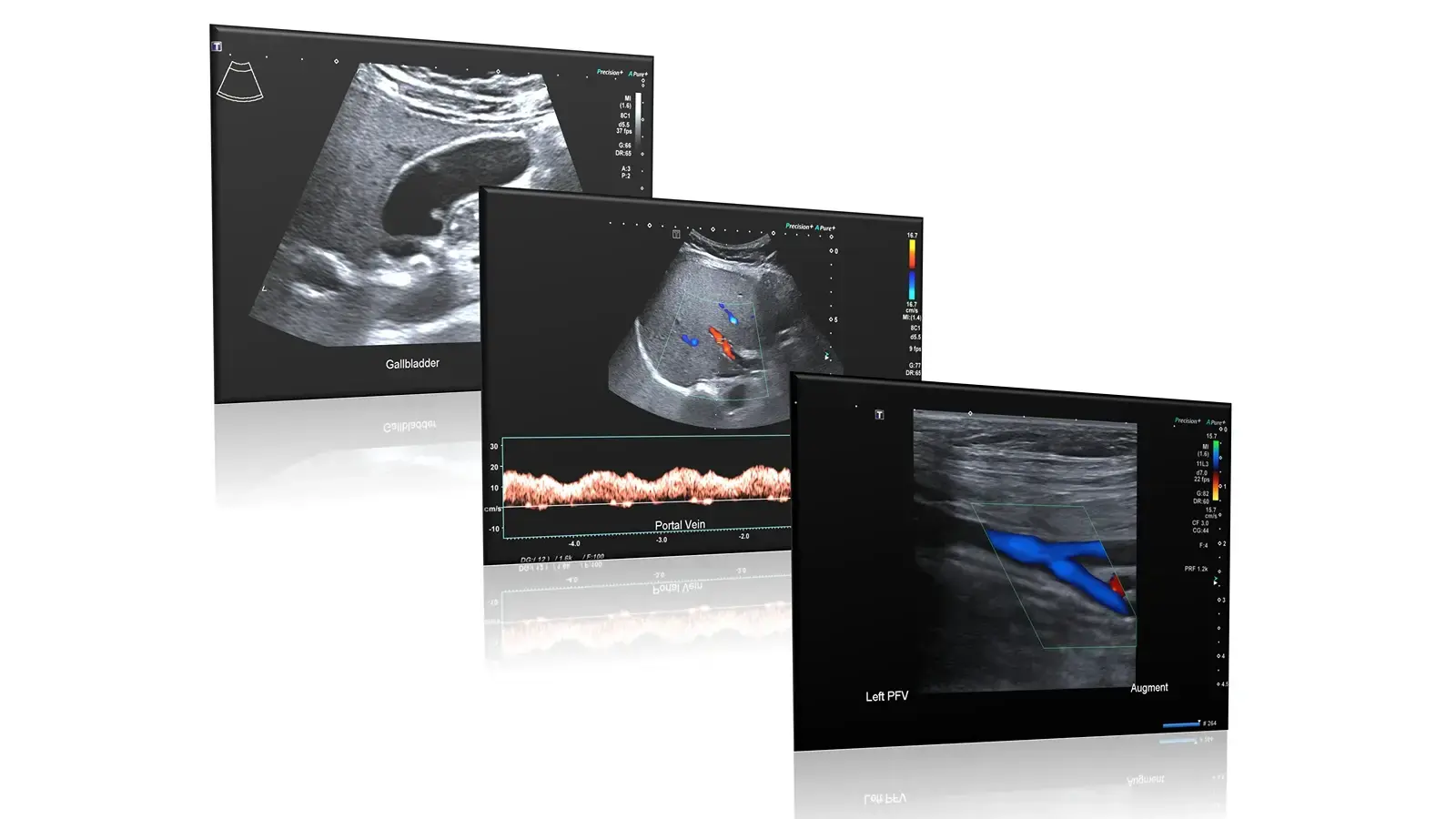 General diagnostic ultrasound scan image of internal organs
