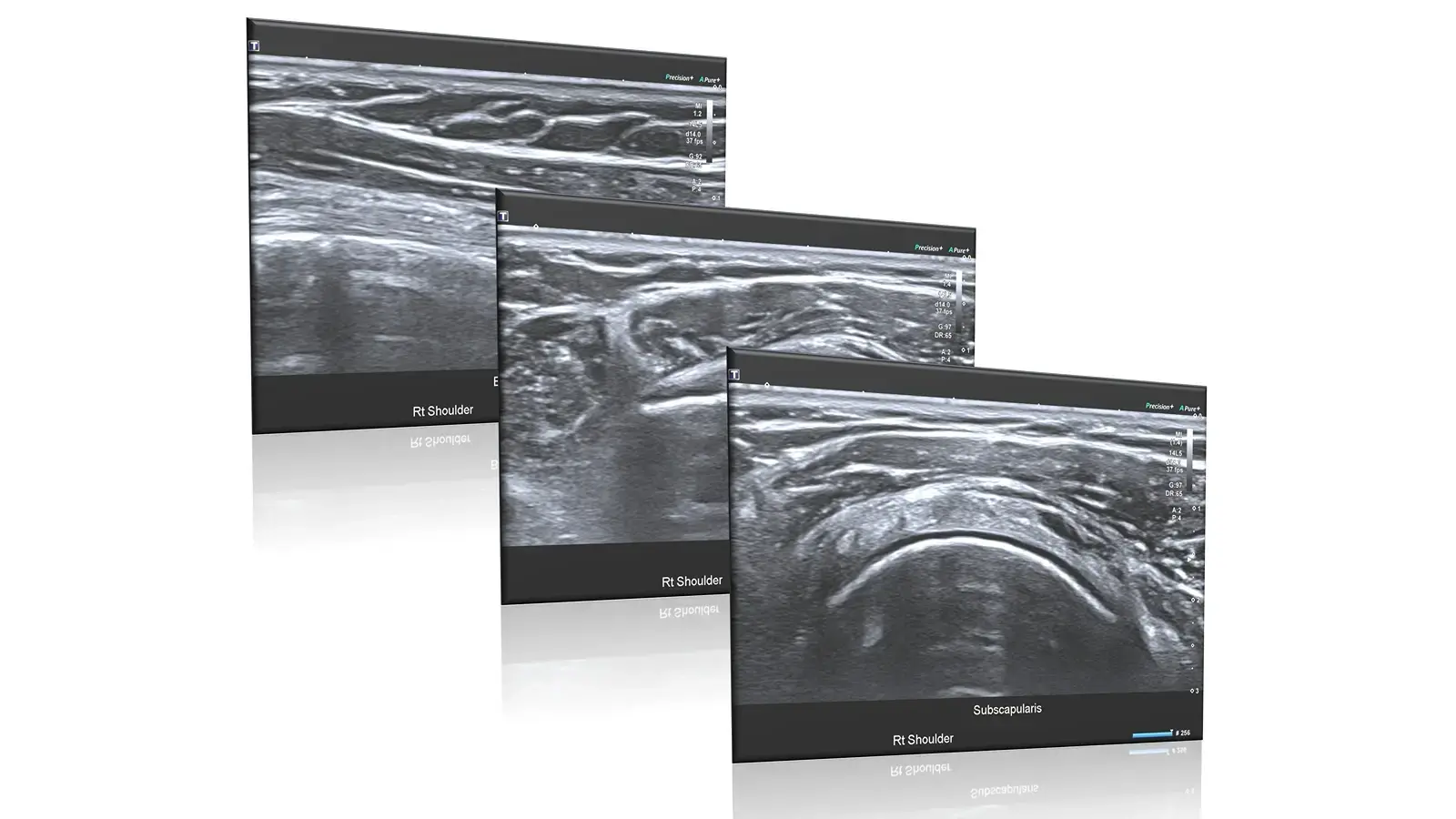 Ultrasound scan image of muscles, tendons and joints