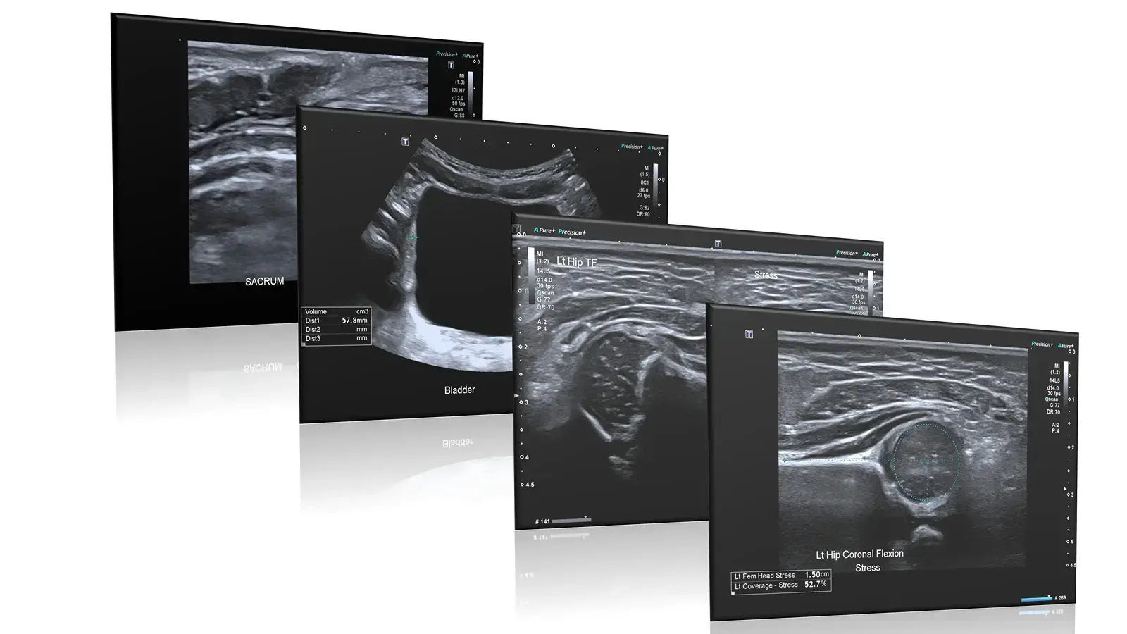 Ultrasound scan image used for paediatric diagnosis