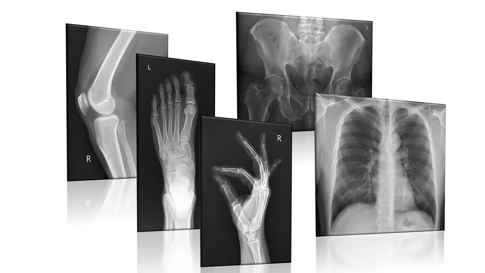 X-ray image showing bone and internal structure